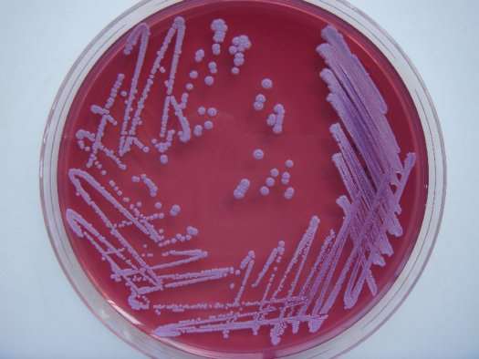 bacteria2_20111102100645.jpg